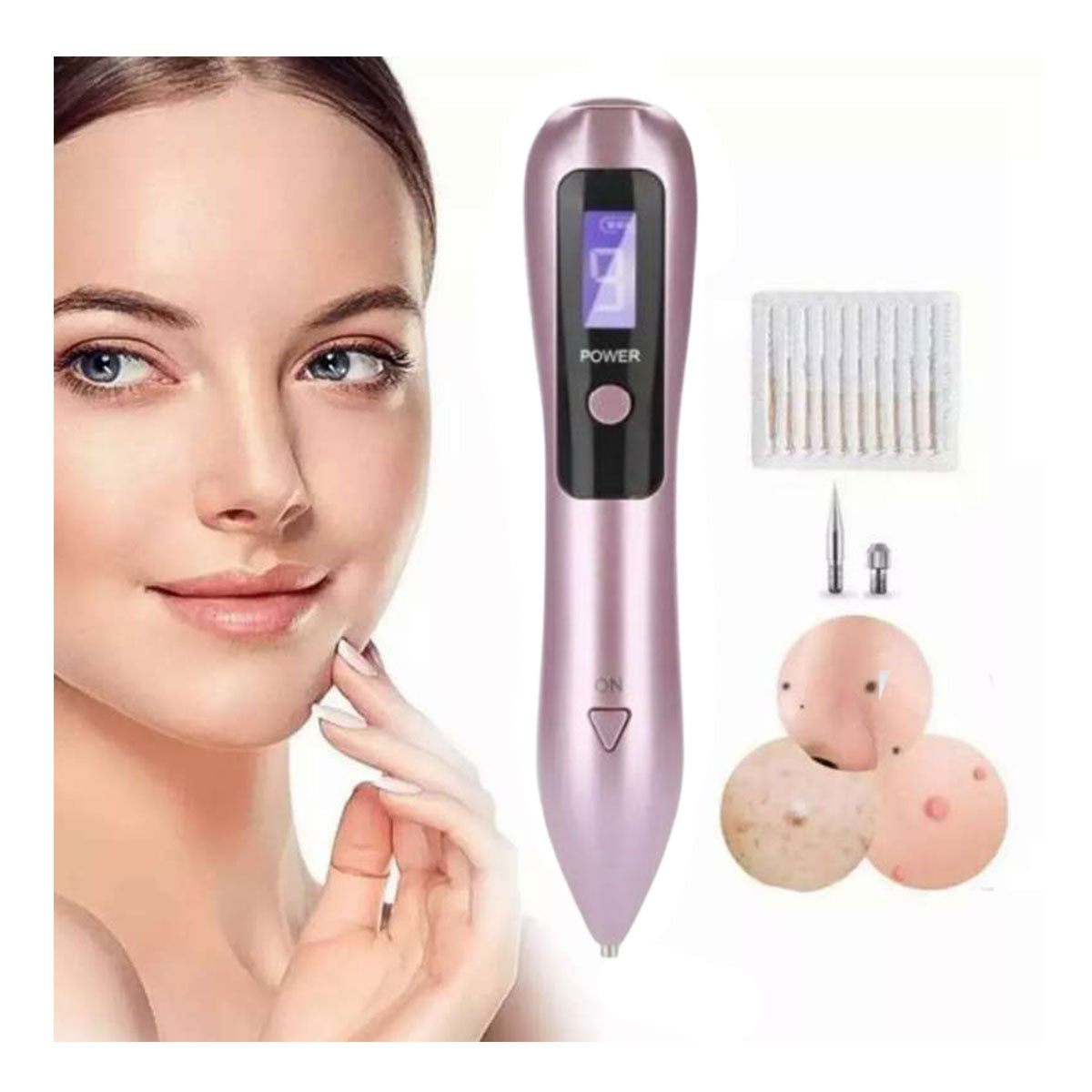Cauterizador Quita Verrugas con Pantalla LED